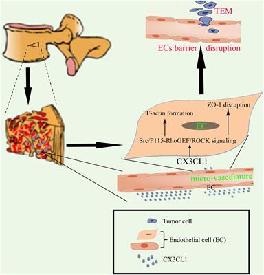 CX3CL1 Induces Vertebral Microvascular Barrier Dysfunction via the Src/P115-RhoGEF/ROCK Signaling Pathway